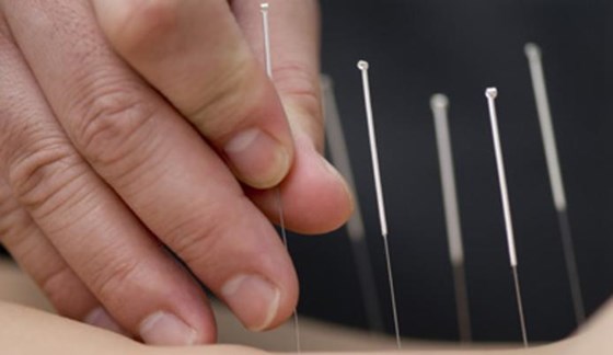 Resources of Physiotherapy treatment: Services