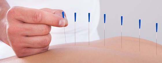 Resources of Physiotherapy treatment: Acupuncture Therapy Resources