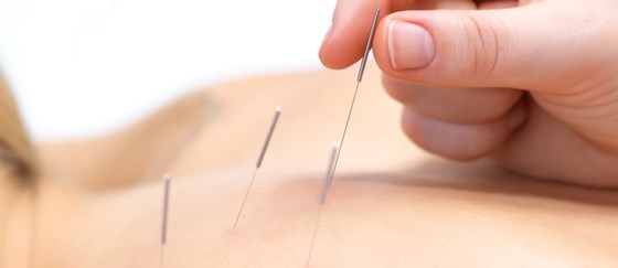 Resources of Physiotherapy treatment: Acupuncture Therapy Resources